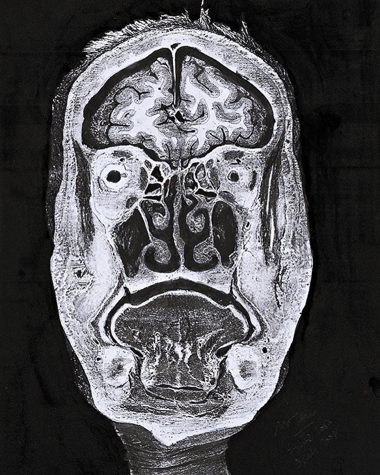 Beyin 3 / Brain 3